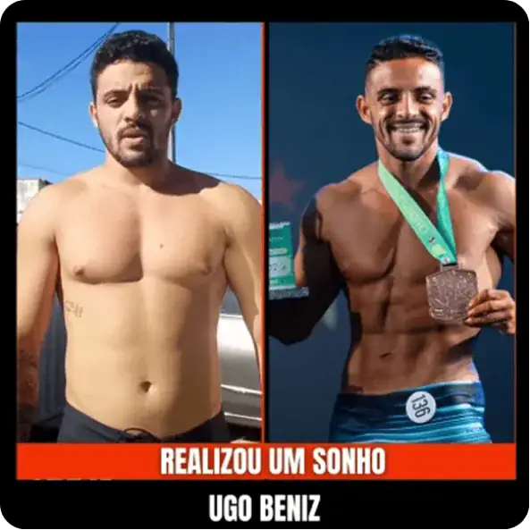Antes e depois do tratamento V-Shape para queima de gordura e definição corporal.