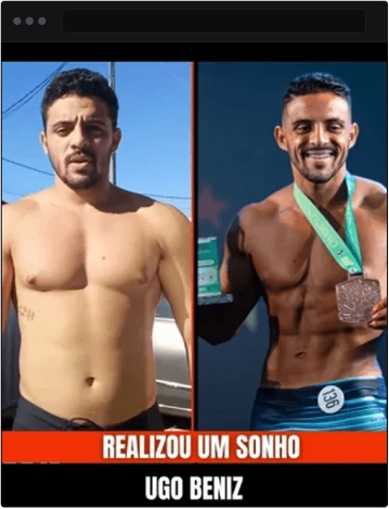 Homem antes e depois do procedimento V-Shape para emagrecimento.